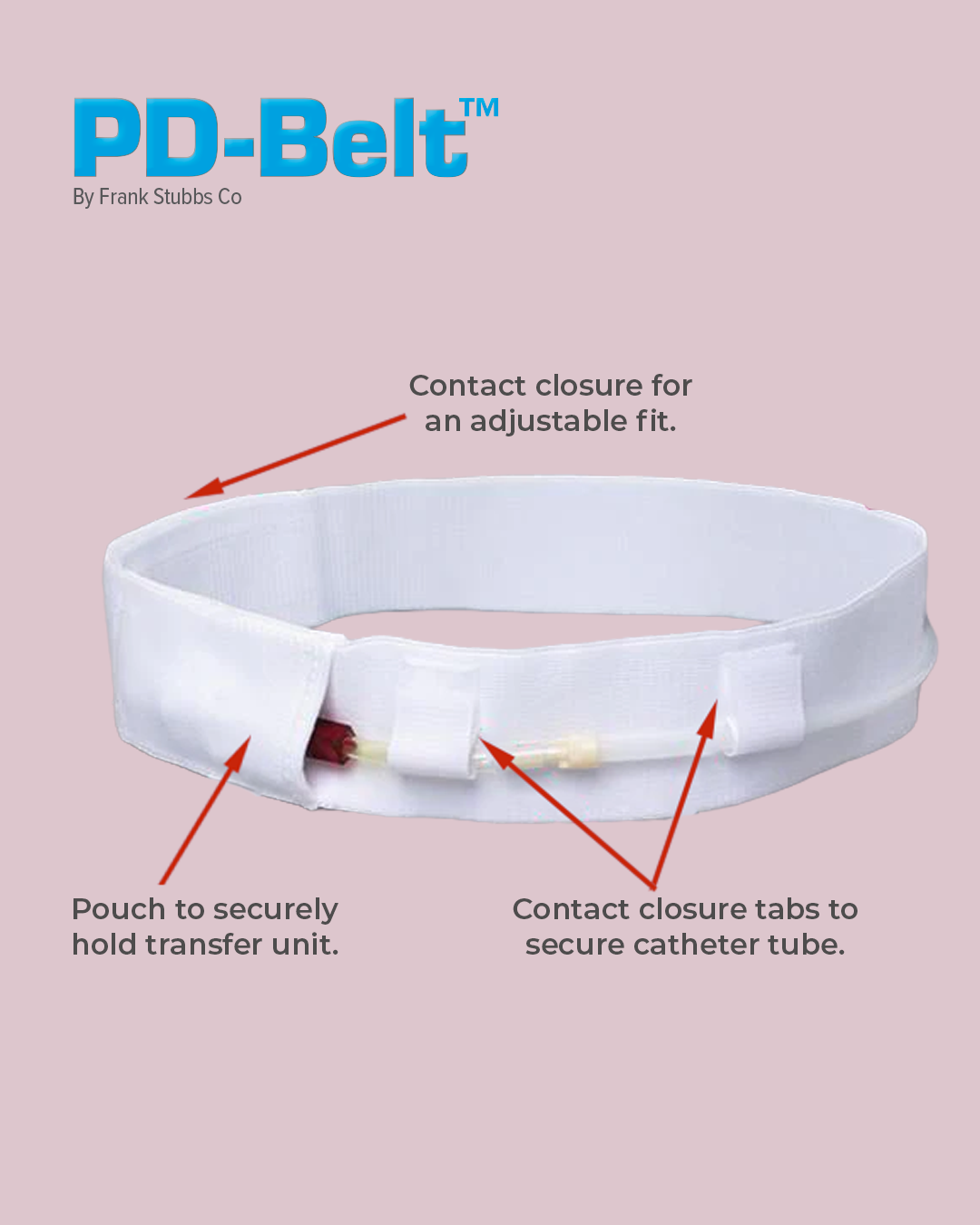 Single Peritoneal Dialysis (PD) Belt with points of interest explained.