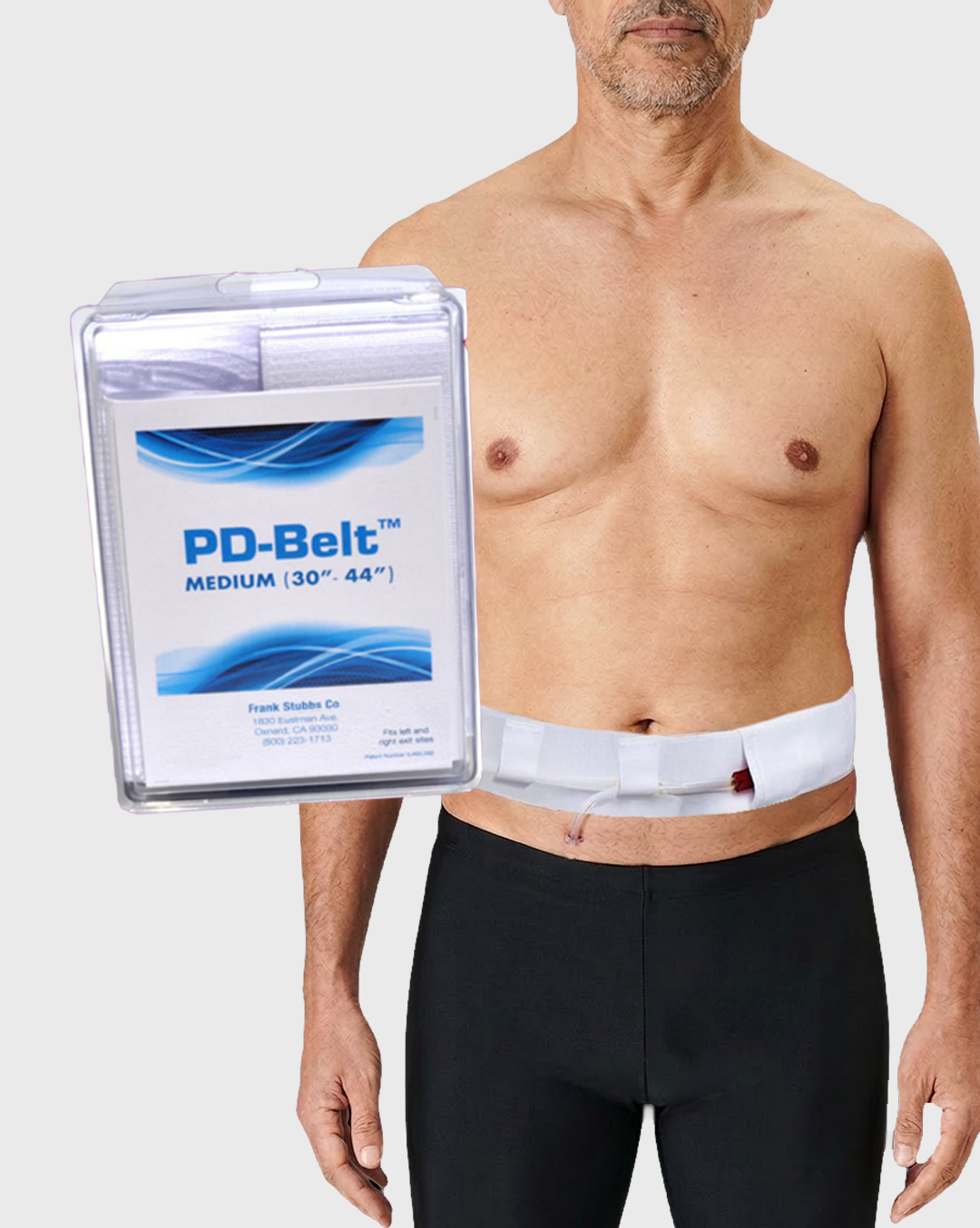 Peritoneal Dialysis Belt (3 Pack)